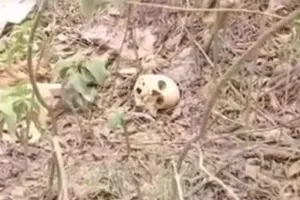 मेडिकल कॉलेज के पीछे मिले मानव  कंकाल