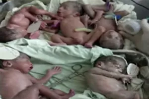 जयपुर में जब 5 बच्चों को महिला ने दिया जन्म