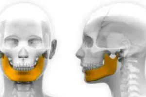 3डी प्रिटिंग टेक्नॉलॉजी की मदद से कैंसर ग्रस्त रहे मरीज का जबड़ा फिर लगा