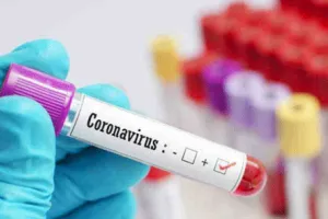 स्विटजरलैंड के सशस्त्र बलों के प्रमुख थॉमस कोरोना पॉजिटिव