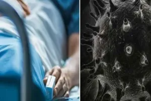 भिवानी ब्लैक फंगस का कहर, 10 मरीज मिले