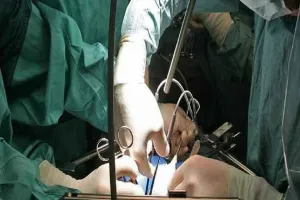 लापरवाही: अस्पताल ने पथरी की जगह निकाली किडनी, मौत