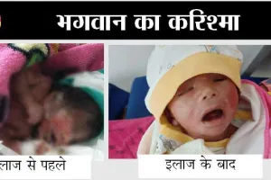 Charisma of God: प्लास्टिक चमड़ी वाले शिशु का पुनर्जन्म