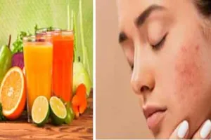 Pimples: चेहरे पर दाग-धब्बों से हो परेशान, तो अपनाएं ये समाधान पीएं ये हर्बल ड्रिंक