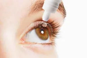 Eye Flu: आई फ्लू का कहर, क्या है लक्षण और कैसे करें बचाव …