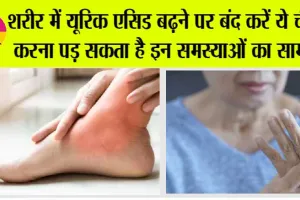 Diet Tips For Uric Acid: यूरिक एसिड बढ़ने पर तुरंत खाना छोड़ दें ये चीजें