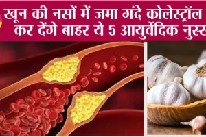 Control Bad Cholesterol: खून की नसों में जमा गंदे कोलेस्ट्रॉल को कर देंगे बाहर ये 5 आयुर्वेदिक नुस्खे