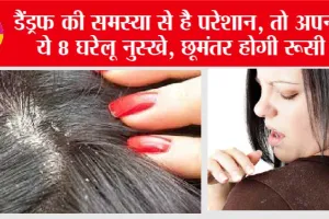 Get Rid Of Dandruff: डैंड्रफ की समस्या से है परेशान, तो अपनाएं ये 8 घरेलू नुस्खे, छूमंतर होगी रूसी
