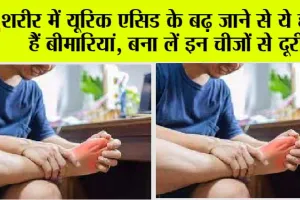 High Uric Acid: शरीर में यूरिक एसिड के बढ़ जाने से ये होती हैं बीमारियां, बना लें इन चीजों से दूरी