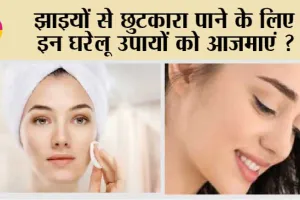Home Remedies for Pigmentation: झाइयों से छुटकारा पाये सिर्फ़ 7 दिनों में !