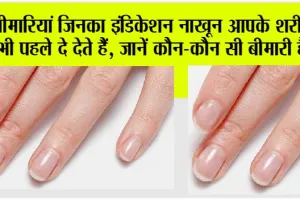 Nails Indication: आपके नाखून भी देते हैं बीमारी का संकेत, रंग देखकर जानें अपनी सेहत का हाल
