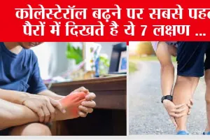 Signs of high cholesterol in legs: कोलेस्टेरॉल बढ़ने पर सबसे पहले पैरों में दिखते है 7 लक्षण …