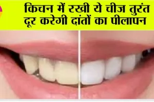 Teeth Whitening Tips: रुपये लगेंगे सिर्फ पाँच, मोतियों से चमकेंगे दाँत