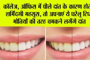 Teeth Whitening Tips: पीले दांतों से लगती है शर्मिंदगी, तो इन नुस्खों को अपनाएं और पाएं दूध जैसी सफेदी