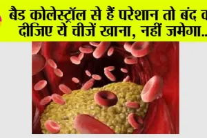 Bad Cholesterol: बैड कोलेस्ट्रॉल बढ़ रहा है तो ना करें इन चीजों का सेवन