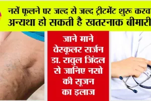 Swollen Veins: क्या फूली हुई नसें हानिकारक हैं? लक्षण, कारण और उपचार, जानें डॉक्टर की जुबानी