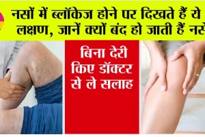 Symptoms of Veins Blockage: शरीर में दिखाई दे रहे हैं ये लक्षण, तो हो जाएं सावधान ब्लॉक हो सकती हैं नसें, बिना देरी किए डॉक्टर से ले सलाह