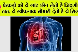 Lungs Problem: फेफड़ों की ये गांठ छीन लेती है जिंदगी के ठाठ, ये खौफनाक बीमारी देती है ये सिग्नल