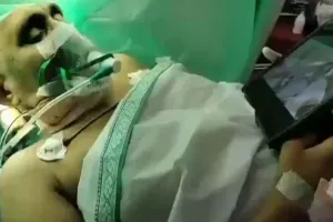 Viral Video: डॉक्टर ब्रेन सर्जरी करते रहे, महिला फिल्म देखती रही!