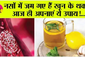 Blood Thinning Food: ये 5 चीजें खाएं और पाएं ब्लड क्लॉट से मुक्ति