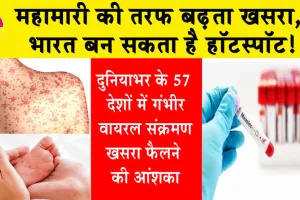 Measles Disease: महामारी की तरफ बढ़ता खसरा, भारत बन सकता है हॉटस्पॉट!