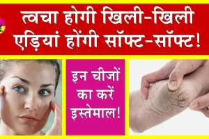 Skin Care Remedies: सर्दियों में त्वचा व फटी एड़ियों से हैं परेशान तो समाधान है आसान!