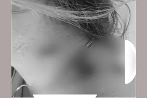Beauty Parlour Firing: ब्यूटी पार्लर संचालिका पर चलाई गोली, कंधे और गर्दन को छूकर निकल गई गोली