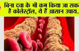 Cholesterol Level: बिना दवा के भी कम किया जा सकता है कोलेस्ट्रॉल, ये हैं आसान उपाय..