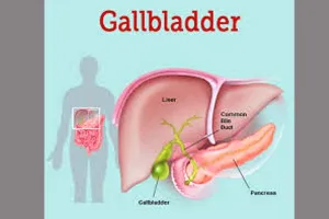 Gallbladder: गुरुग्राम में डॉक्टर्स ने 70 साल के बुजुर्ग के गॉलब्लैडर से निकाली 8125 पथरी