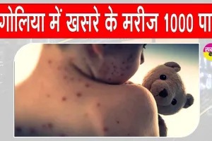 Mongolia’s Confirmed Measles cases: मंगोलिया में खसरे के मामले 10,000 पार, एनसीसीडी ने वैक्सीनेशन की अपील की
