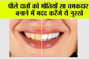 Teeth Cleaning Remedies: पीले दातों को मोतियों सा चमकदार बनाने में मदद करेंगे ये नुस्खे