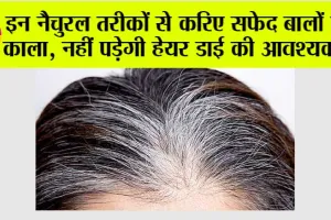 White Hair Remedies: इन नैचुरल तरीकों से करिए सफेद बालों को काला, नहीं पड़ेगी हेयर डाई की आवश्यकता