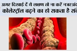 High Cholesterol Signs: दिखाई दें ये लक्षण तो ना करें नजरअंदाज, कोलेस्ट्रॉल बढ़ने का हो सकता है संकेत
