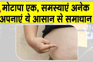 Obesity treatment in Ayurveda: मोटापा अनेक बीमारियों की जड़, कैसे काटें इसकी जड़?