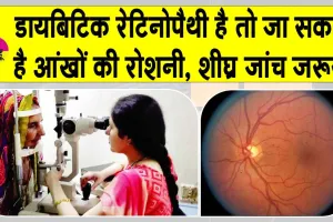 Diabetic Retinopathy: शुगर रोगियों को हो सकता है डायबिटिक रेटिनोपैथी, जिससे आंखों की रोशनी जानें का खतरा!