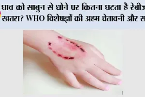 Dog Bite: घाव को साबुन से धोने पर कितना घटता है रेबीज का खतरा? WHO विशेषज्ञों की अहम चेतावनी और सलाह