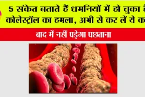 High Cholesterol Signs: 5 संकेत बताते हैं धमनियों में हो चुका है कोलेस्ट्रॉल का हमला, अभी से कर लें ये काम, नहीं तो पछताना पड़ेगा
