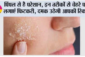 Benefits Of Alum On Skin: पिंपल से है परेशान, इन तरीकों से चेहरे पर लगाएं फिटकरी, दमक उठेगी आपकी स्किन