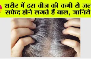 White Hair Problem: “बाल सफेद क्यों होते हैं? जाने क्या है विटामिन B-12 की अहमियत”