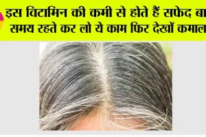 White Hair To Black Hair Naturally: इस विटामिन की कमी से होते हैं सफेद बाल, समय रहते कर लो ये काम फिर देखों कमाल….
