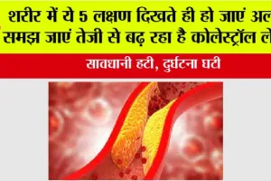 Signs of High Cholesterol: शरीर में ये 5 लक्षण दिखते ही हो जाएं अलर्ट, समझ जाएं तेजी से बढ़ रहा है कोलेस्ट्रॉल लेवल