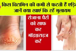 Cracked Heels Cause: किस विटामिन की कमी से फटती हैं एड़ियां? जानें क्या खाएं कि रहें मुलायम