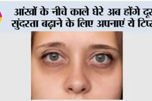 Dark Circle Tips: डार्क सर्कल होंगे गायब, चेहरा दिखेगा दमकता! सर्दियों में अपनाएं ये घरेलू नुस्खा…