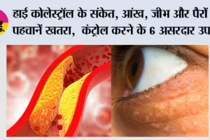 High Cholesterol Symptoms: हाई कोलेस्ट्रॉल के संकेत, आंख, जीभ और पैरों से पहचानें खतरा,  कंट्रोल करने के 6 असरदार उपाय