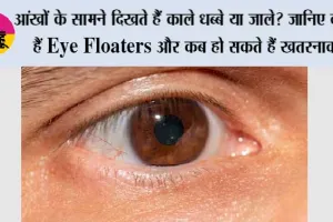 Eye Floaters Symptoms: आंखों के सामने दिखते हैं काले धब्बे या जाले? जानिए क्या हैं Eye Floaters और कब हो सकते हैं खतरनाक