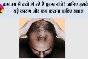 Hair Loss in Men: कम उम्र में क्यों हो रहे हैं पुरुष गंजे? जानिए इसके 5 बड़े कारण और कब कराना चाहिए इलाज
