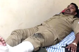 नेशनल हाइवे पर कार की चपेट में आया हेड कांस्टेबल, पैर टूटा