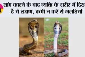Snake News: सांप काटने के बाद भूलकर भी न करें ये गलतियां, समय पर सही इलाज बचा सकता है जान