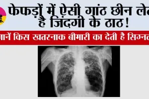 Symptoms of lung nodules: फेफड़ों में ऐसी गांठ छीन लेती है जिंदगी के ठाठ! जानें किस खतरनाक बीमारी का देती है सिग्नल 