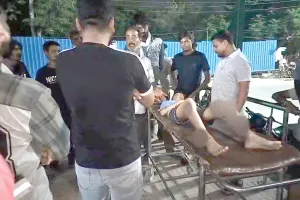 Pitbull Dog Attack: पिटबुल कुत्ते ने सातवीं कक्षा के छात्र को 16 जगह काटा